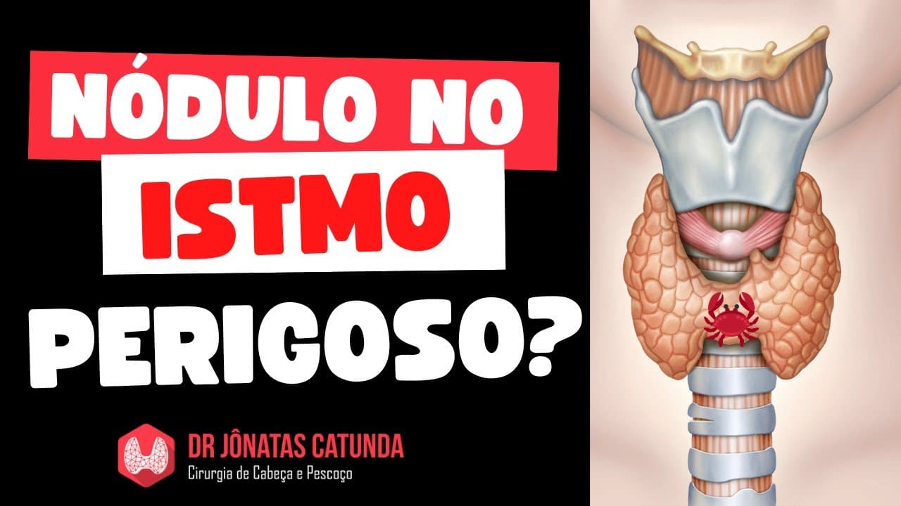 Nódulo no istmo da tireoide é perigoso?