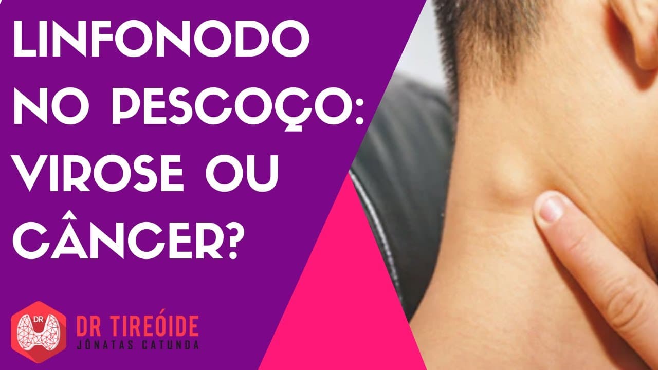 Linfonodo do pescoço - Virose ou câncer?