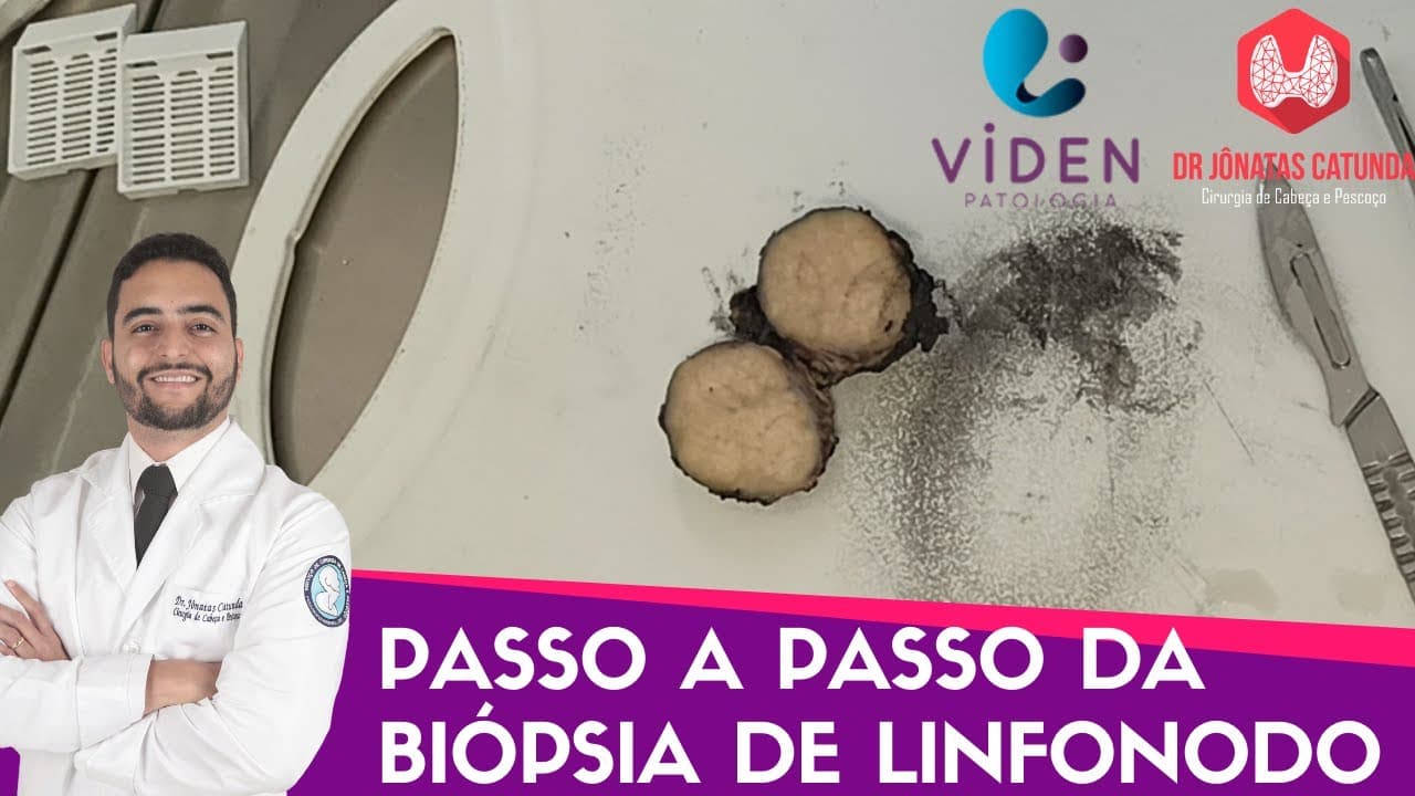 Como é feita a biopsia de linfonodo - processamento do material pelo laboratório