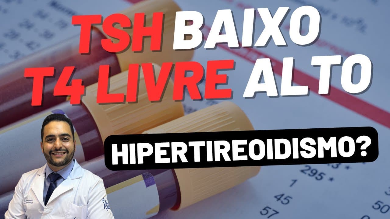 TSH BAIXO, T4 LIVRE ALTO - HIPERTIREOIDISMO POR DOENÇA DE GRAVES