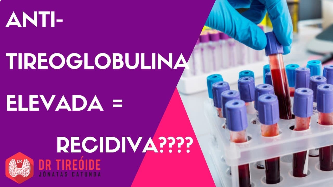 Anti-tireoglobulina elevada pode ser recidiva?