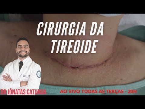 Tireoidectomia - Tire suas dúvidas nessa live com Dr Jônatas Catunda