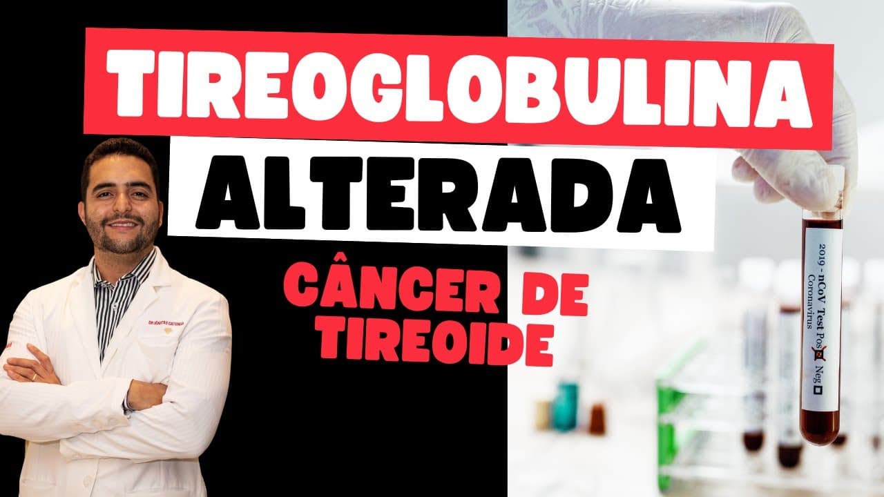 Recidiva do câncer de tireoide? Tireoglobulina subindo pode ser preocupante