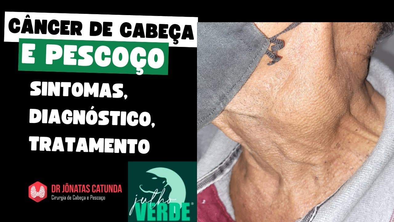 Câncer de cabeça e pescoço - Julho verde