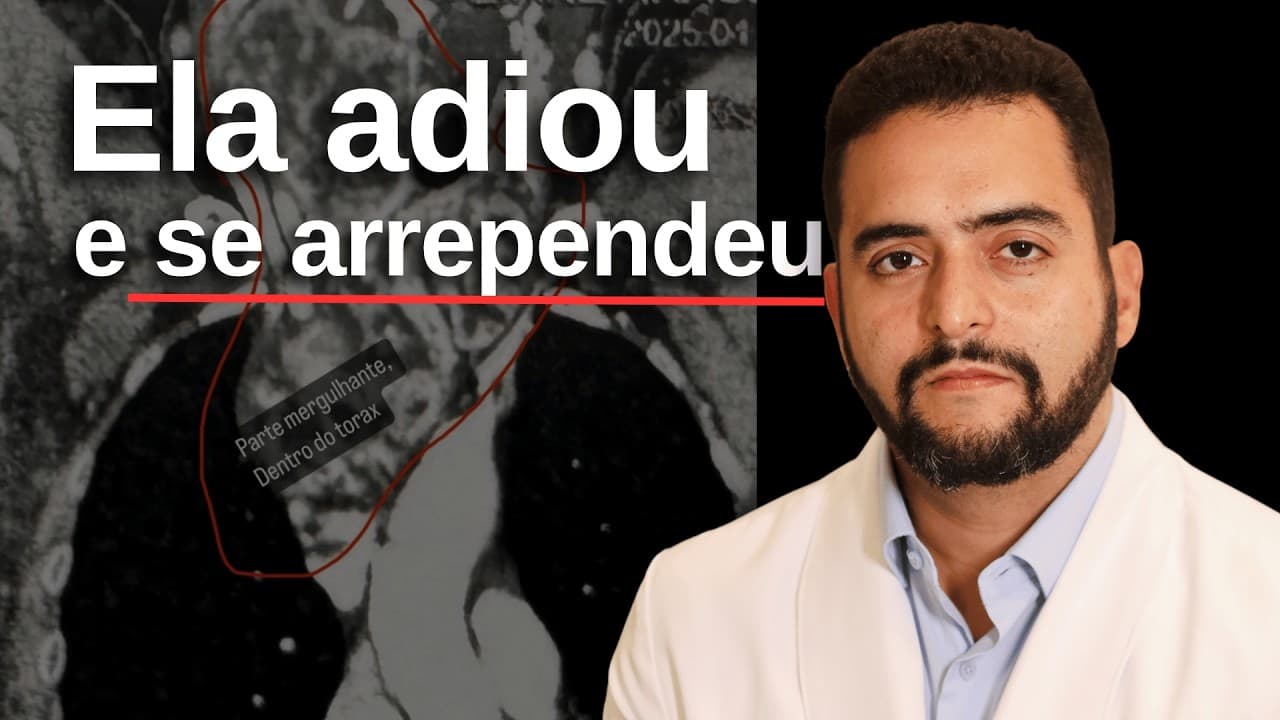 Ela adiou a cirurgia e se arrependeu: o bócio virou mergulhante | Dr. Jônatas Catunda