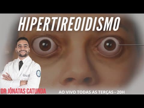 Tratamento do Hipertireoidismo | Dr Jônatas Catunda