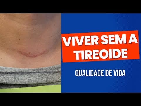 Viver sem a tireoide - é possível ter qualidade de vida?