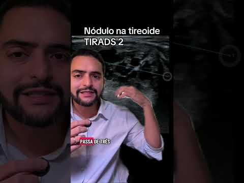 TIRADS 2 no ultrassom: o que significa e o que é nódulo espongiforme