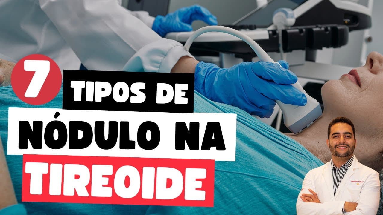 Descubra os 7 Tipos Mais Comuns de Nódulo na Tireoide e Como Identificá-los