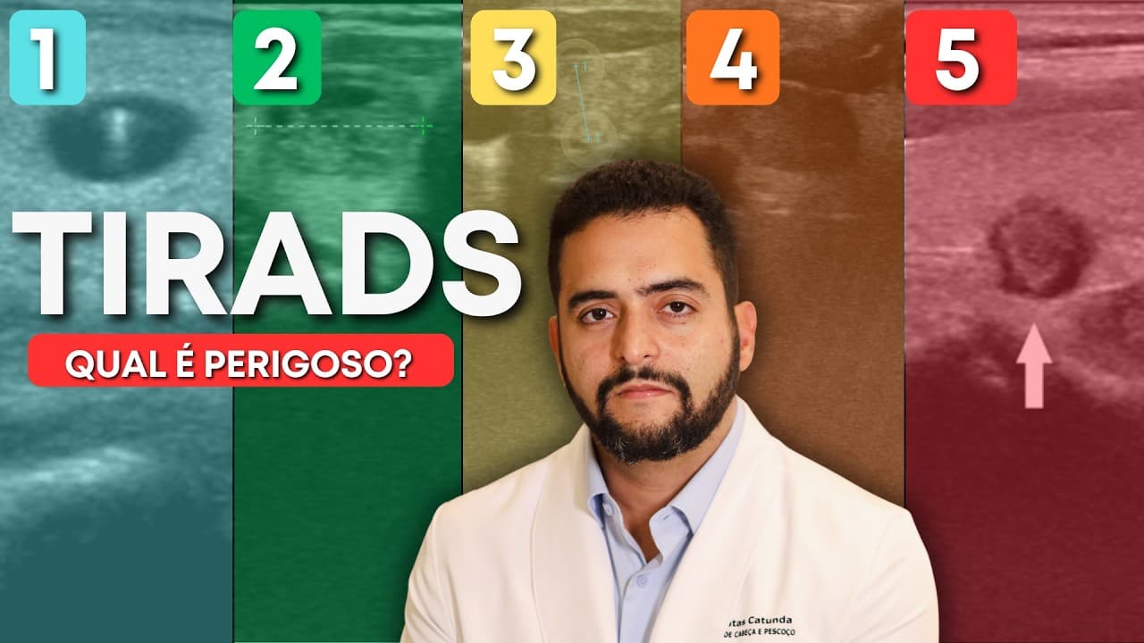 TIRADS 1 a 5: qual realmente indica risco de câncer? | Dr. Jônatas Catunda