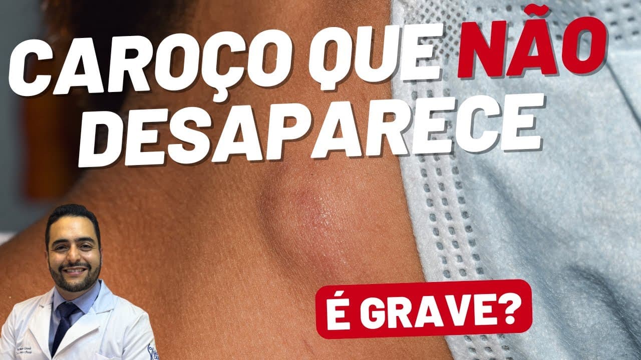 Caroço no Pescoço Que Não Some: Quando se Preocupar?