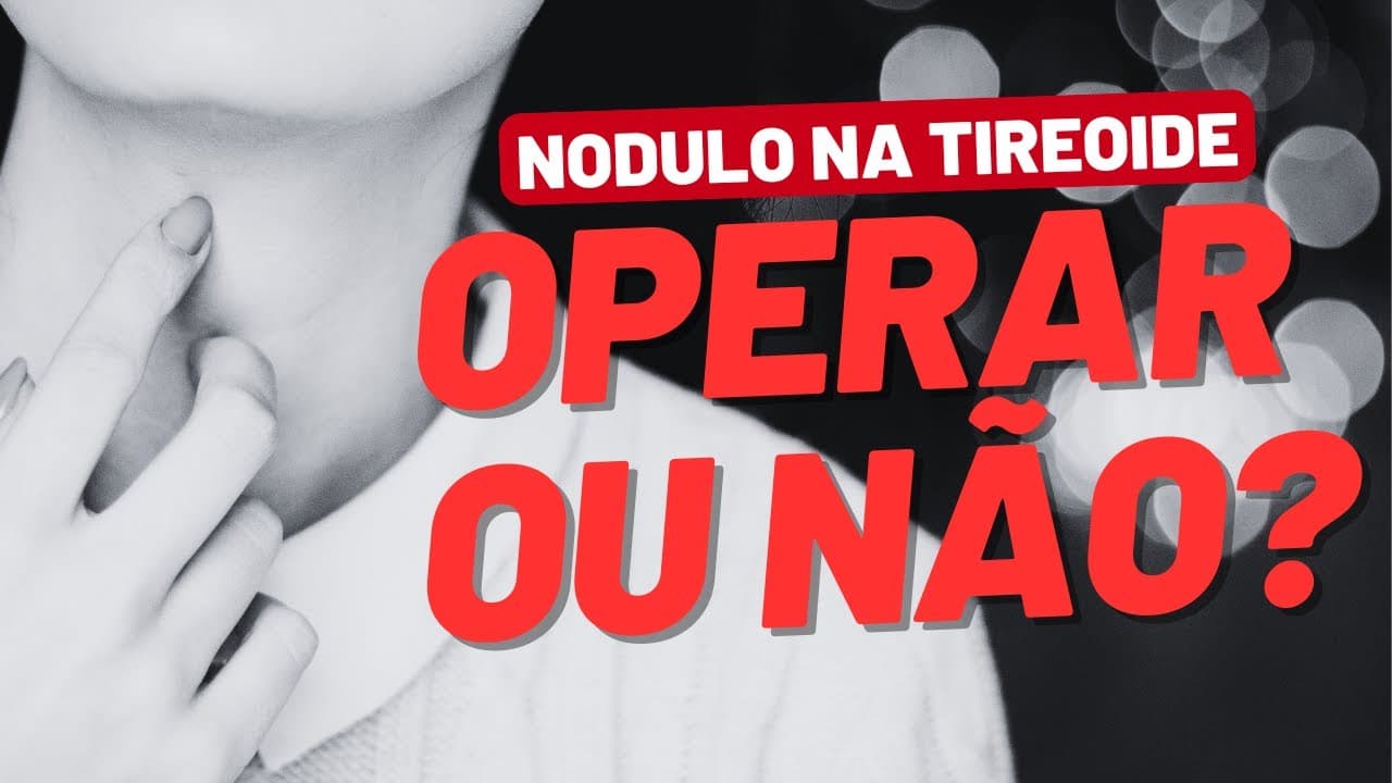 Nódulo benigno de 4 cm na tireoide: operar ou acompanhar?