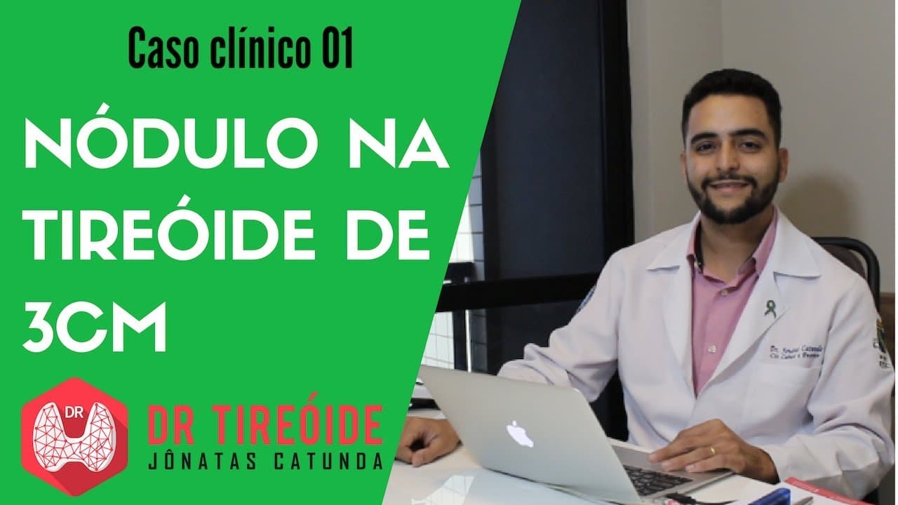 Nódulo na tireóide de 3cm - Caso clínico | Dr Jônatas Catunda