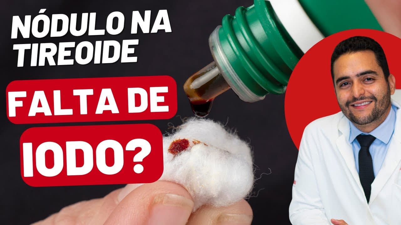 Nódulo na Tireoide: Será que a Deficiência de Iodo é a Causa?