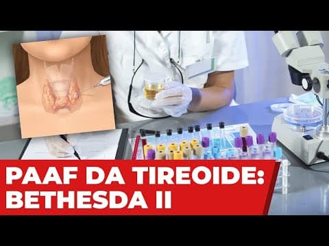 Resultado Bethesda II da punção da tireoide - Benigno - zero preocupação?