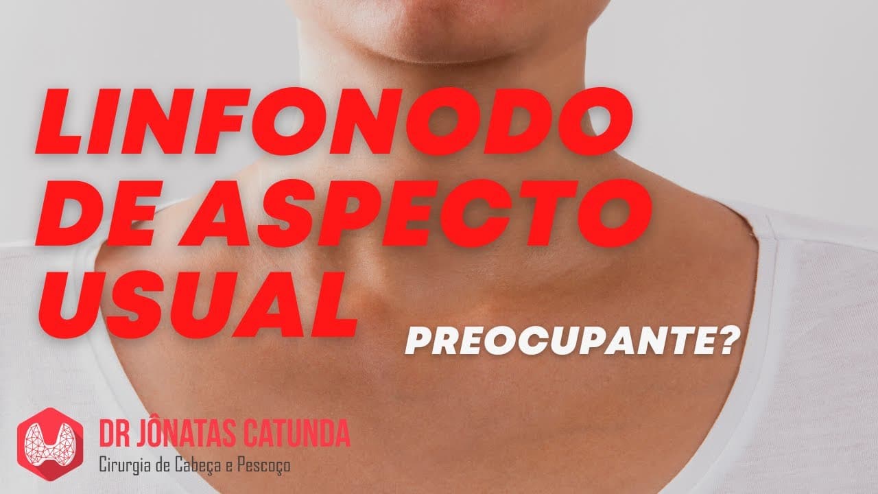 Linfonodo de aspecto usual descoberto no ultrassom - Preocupante?