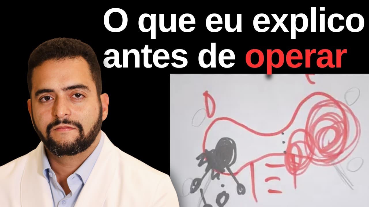 Riscos da cirurgia da tireoide: como eu explico isso aos meus pacientes | Dr. Jônatas Catunda