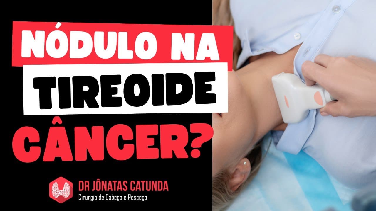 Nódulo na tireoide - como saber se é câncer?