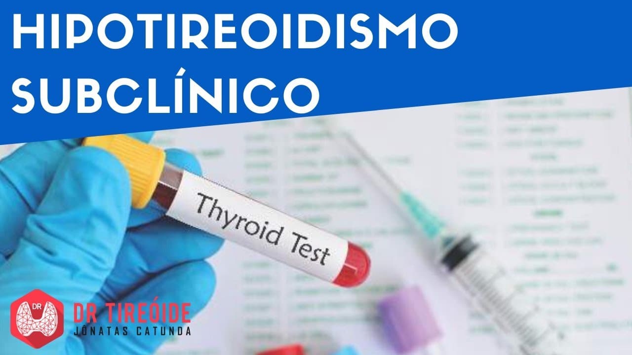 Hipotireoidismo Subclínico - TSH elevado /T4 livre normal - Dr Tireóide Responde