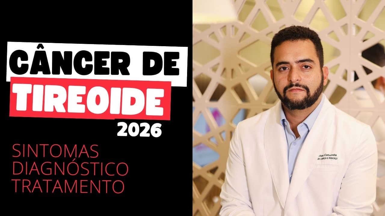 CÂNCER DE TIREOIDE: o que é, sintomas, tratamento e chances de cura (2026) | Dr. Jônatas Catunda