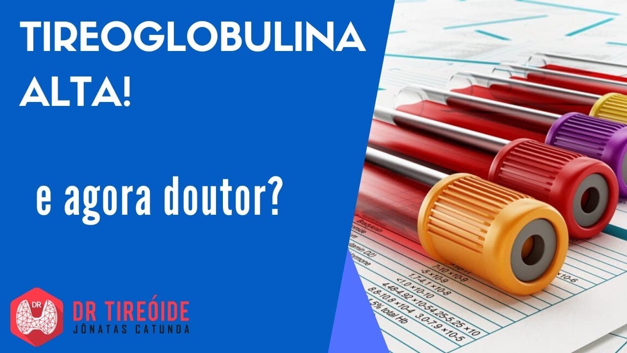 Tireoglobulina alta! E agora doutor? - Dr Tireóide responde