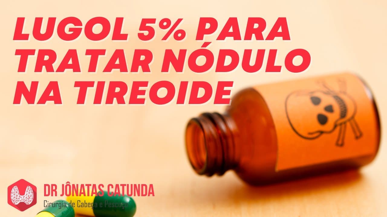 Lugol 5% para tratar nódulo na tireóide - funciona?