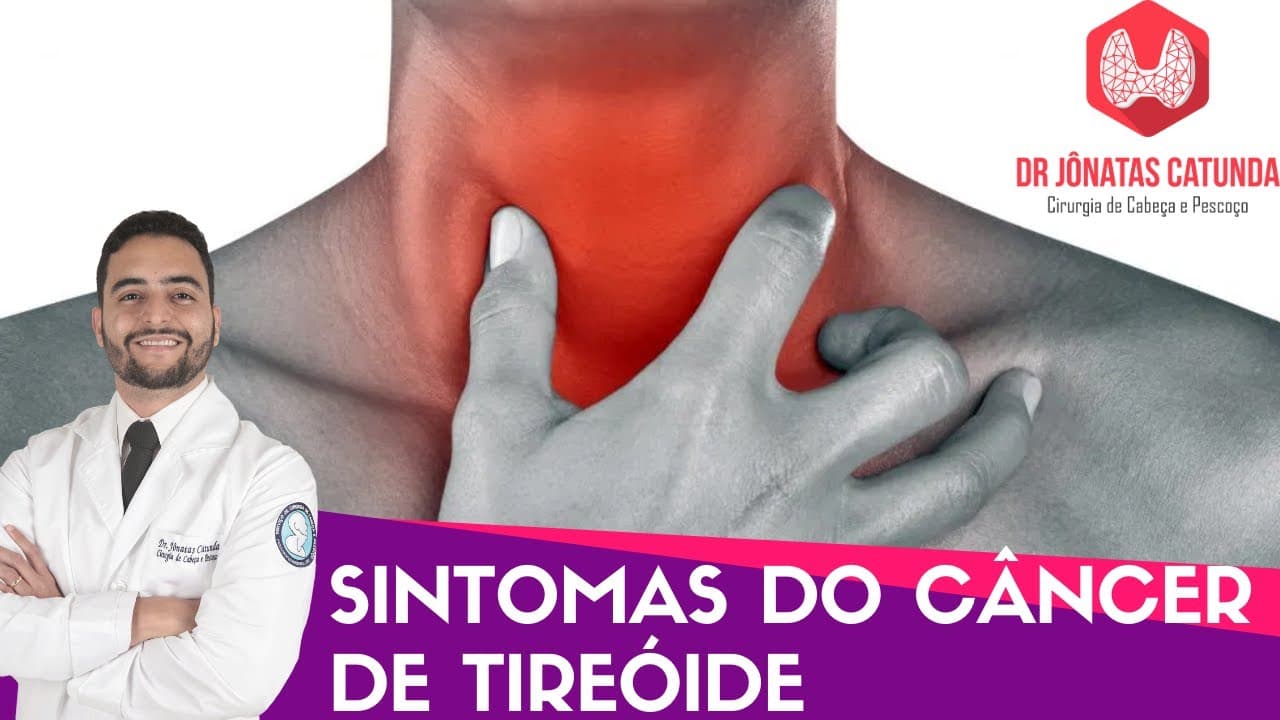 Sintomas do câncer de tireoide - Caroço no pescoço? Rouquidão? Dor na garganta?