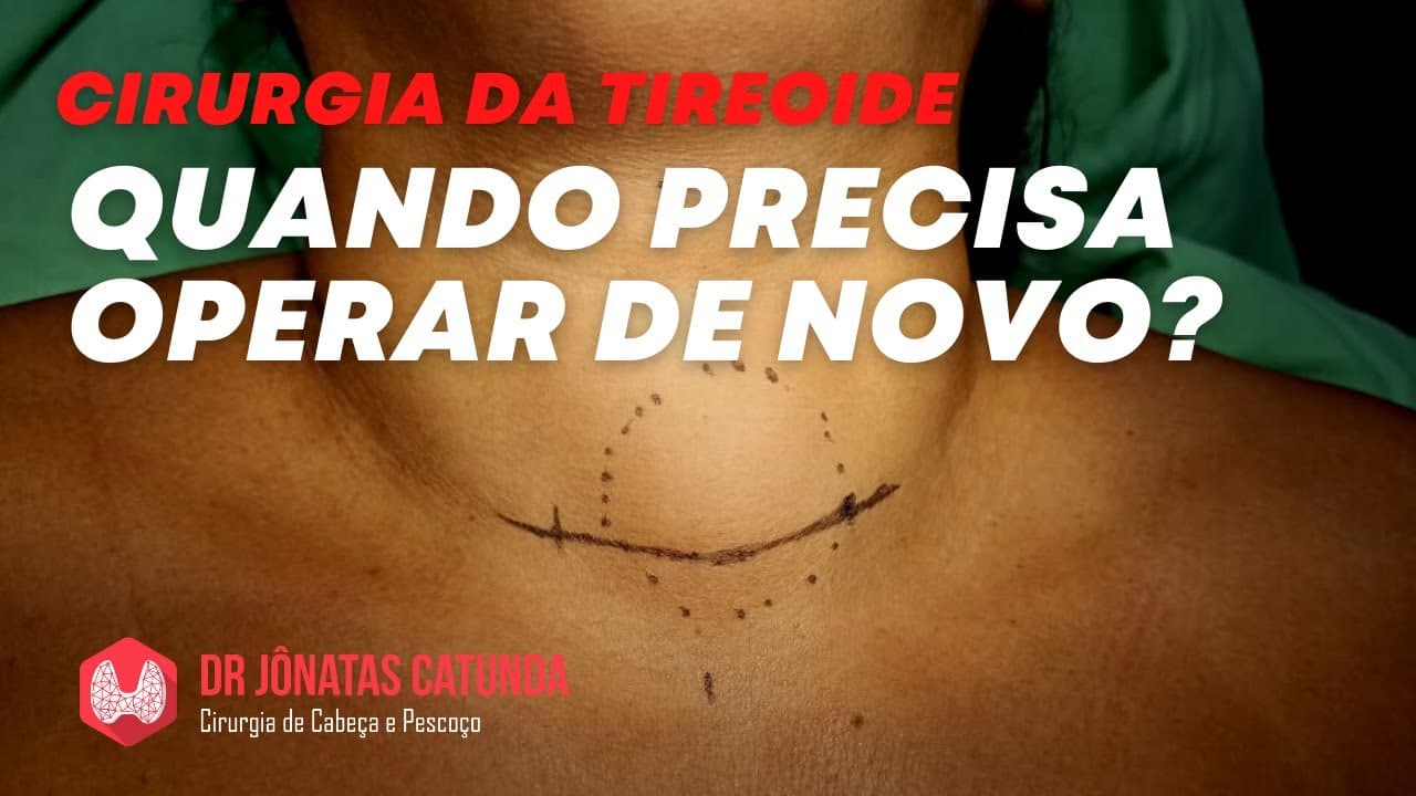 Tireoidectomia - é possível ter que operar de novo?