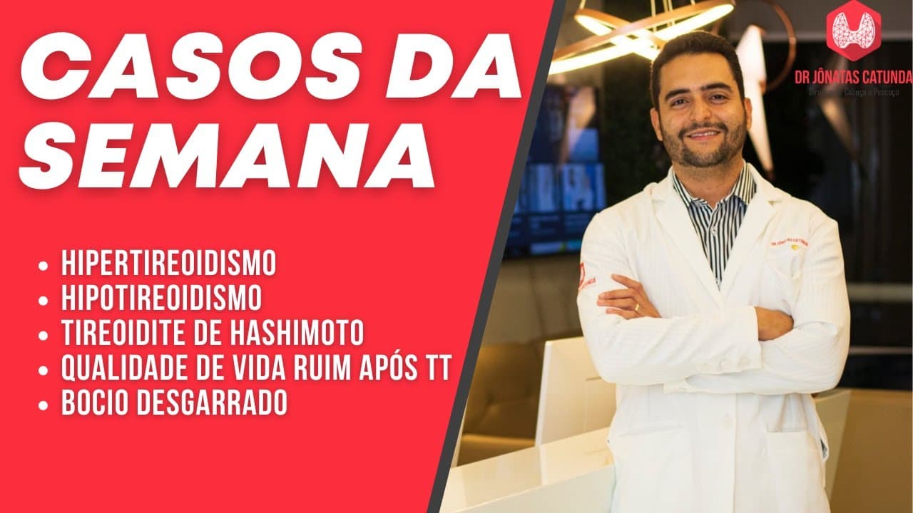 Casos da semana - Hipertireoidismo, hipotireoidismo, Tireoidite de Hashimoto, bocio desgarrado