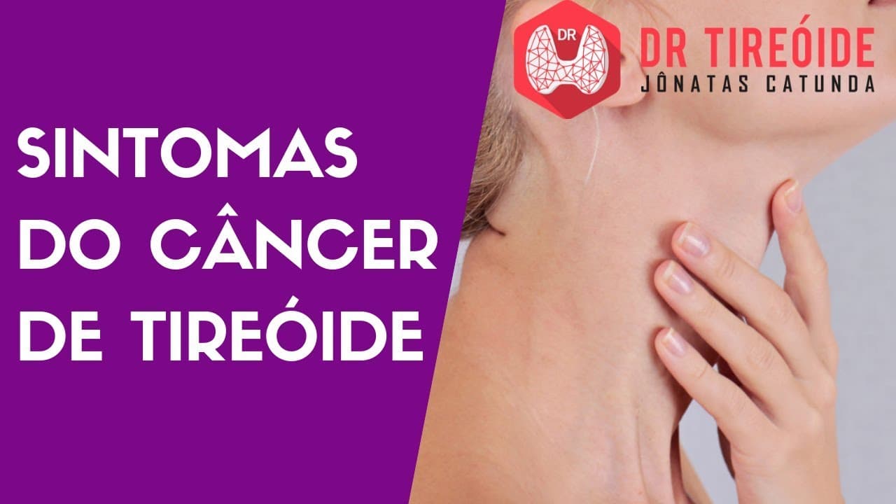 Sintomas do Câncer de Tireóide | Dr Jônatas Catunda