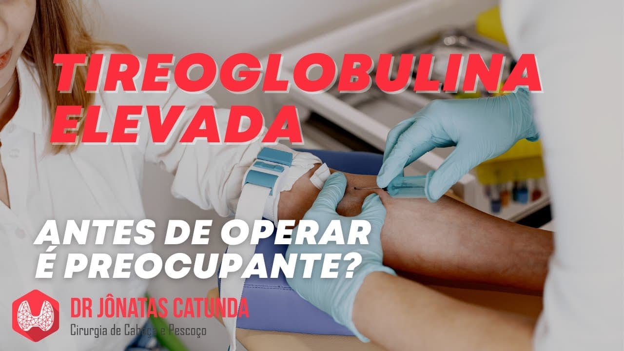Tireoglobulina elevada antes de operar - câncer de tireoide