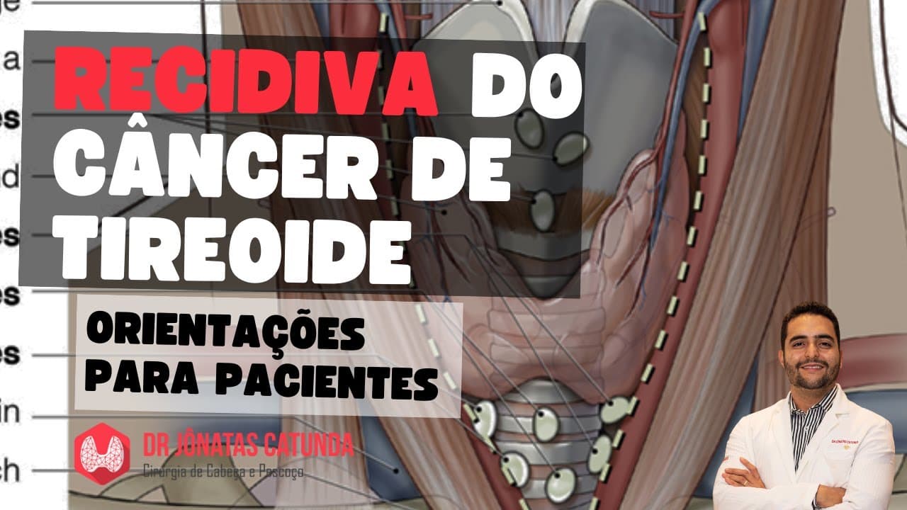 Recidiva do câncer de tireoide - orientações para pacientes