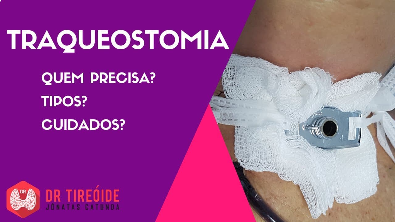 Tudo sobre Traqueostomia - Indicações, tipos, cuidados!