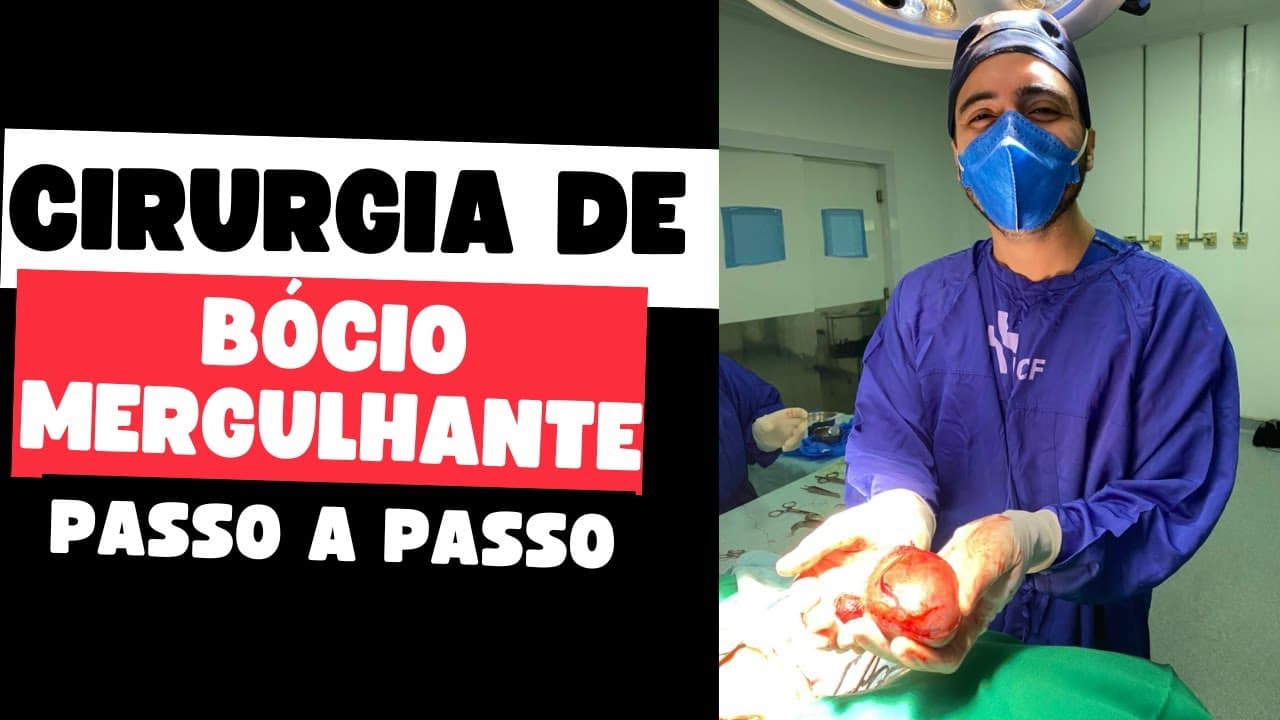 Cirurgia do bócio mergulhante: assista ao procedimento completo