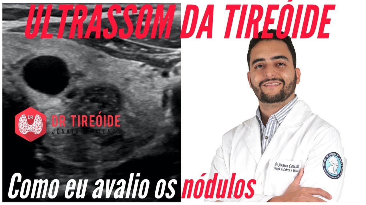 Ultrassom da tireóide - Como eu avalio os nódulos! | Dr Jônatas Catunda
