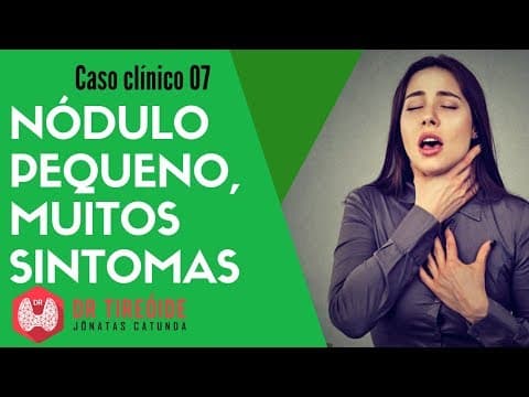 Nódulo pequeno, muitos sintomas - Globus Faríngeo - Caso clínico | Dr Jônatas Catunda