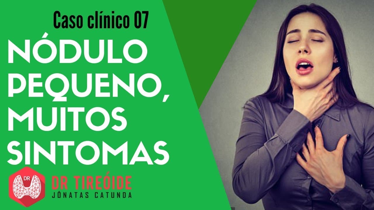 Nódulo pequeno, muitos sintomas - Globus Faríngeo - Caso clínico | Dr Jônatas Catunda