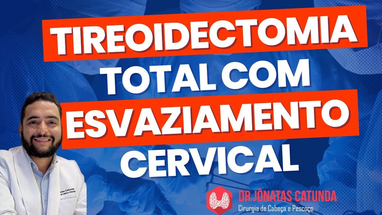 Tireoidectomia total com esvaziamento cervical - Câncer de tireoide
