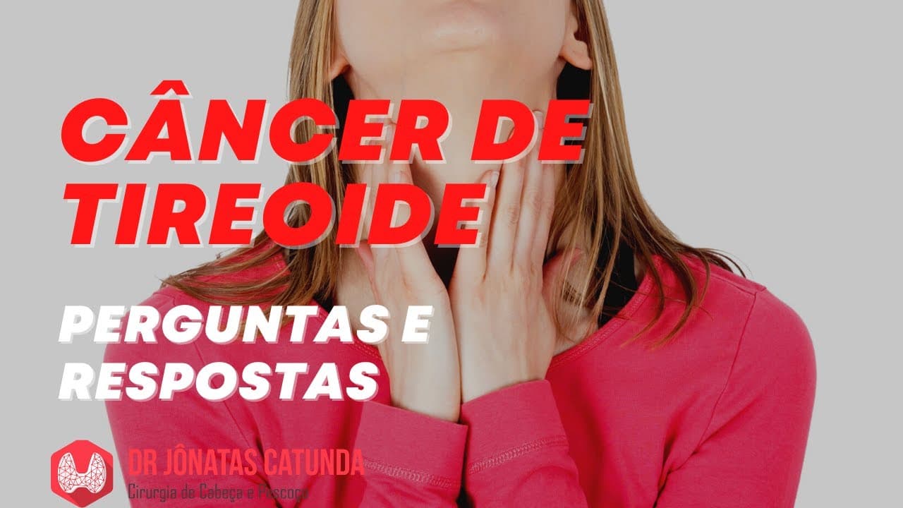 Câncer de tireoide - respondendo perguntas ao vivo!