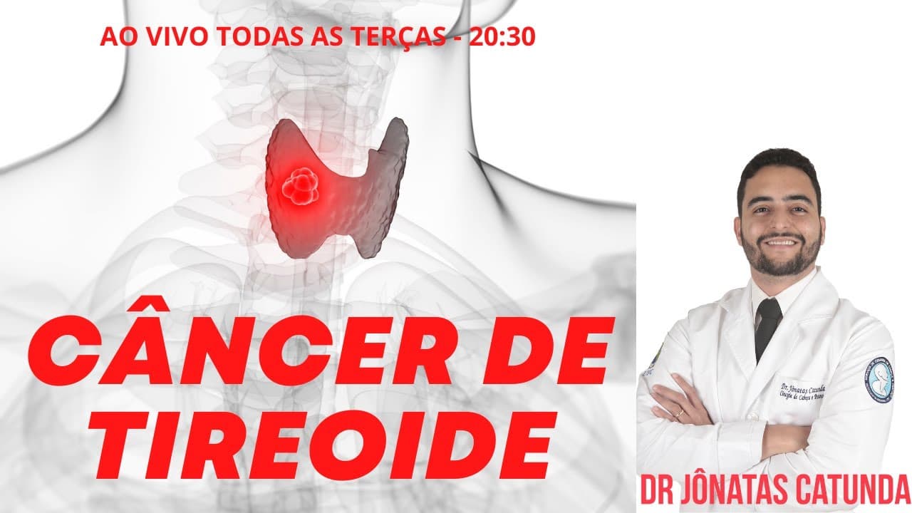 Tire suas dúvidas - Live sobre câncer de tireoide com cirurgião de cabeça e pescoço