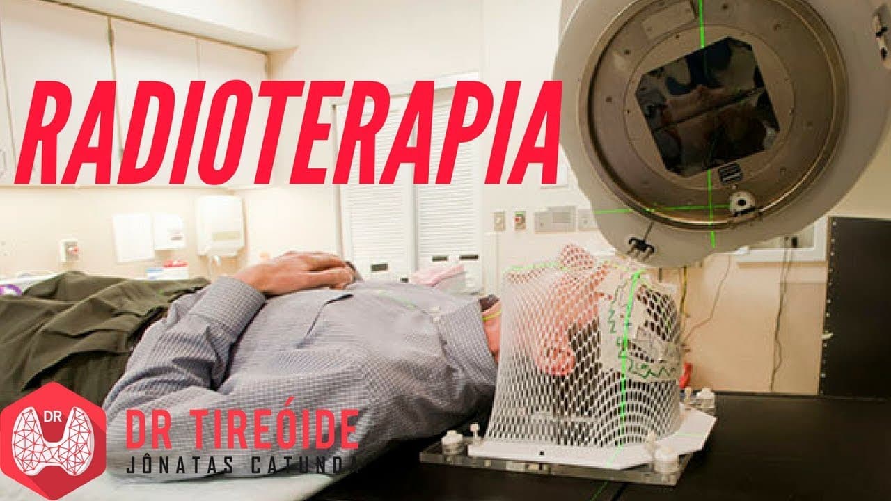 Radioterapia - entenda como funciona esse tratamento! | Dr Jônatas Catunda