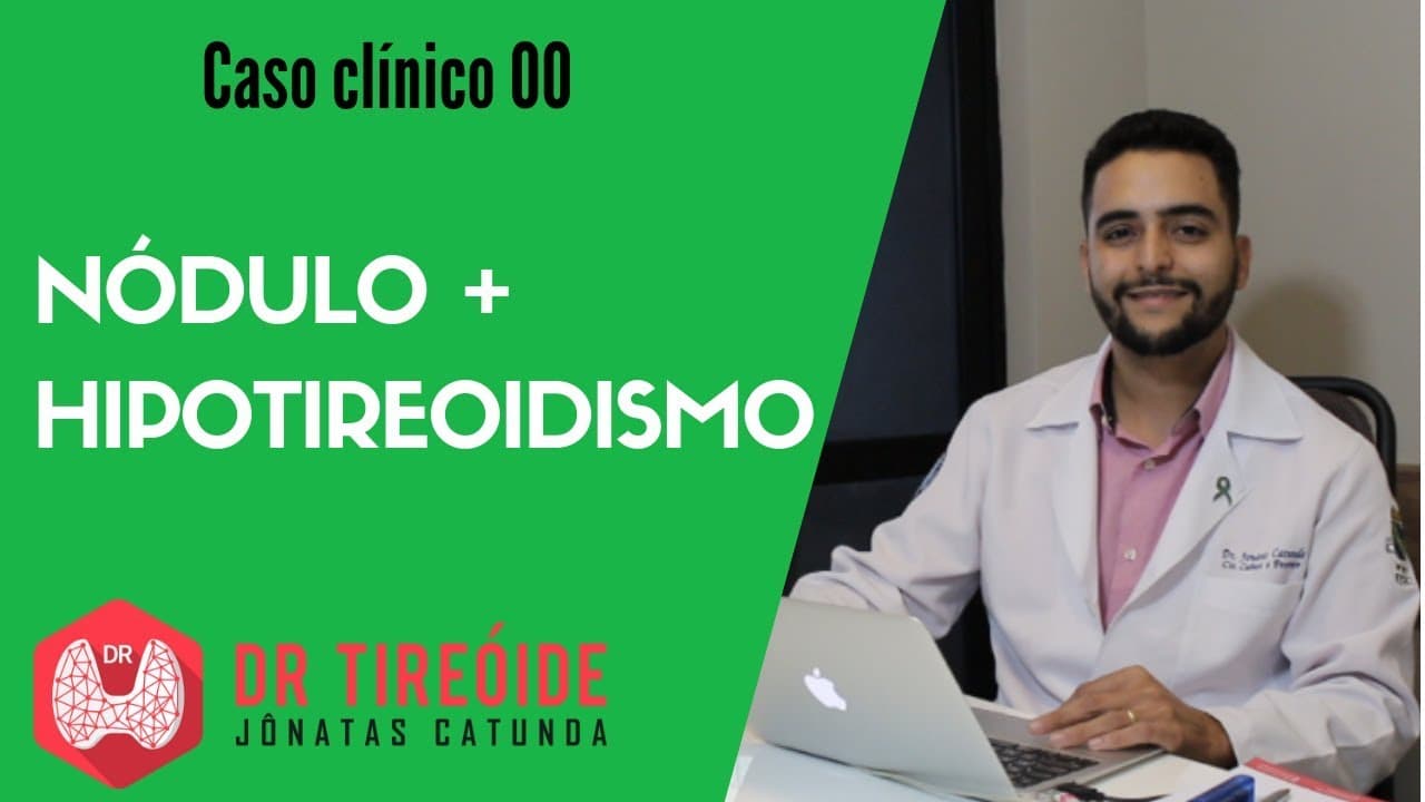 Hipotireoidismo e Nódulos na tireóide - Caso clínico 00 (Episódio Piloto) | Dr Jônatas Catunda