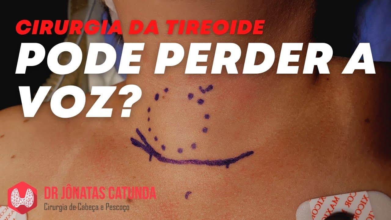 Tireoidectomia - pode perder a voz?