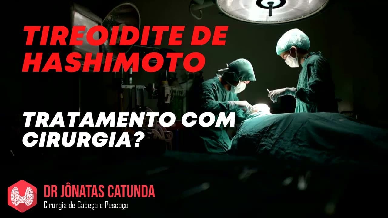 Tireoidite de Hashimoto: é possível tratar com cirurgia?