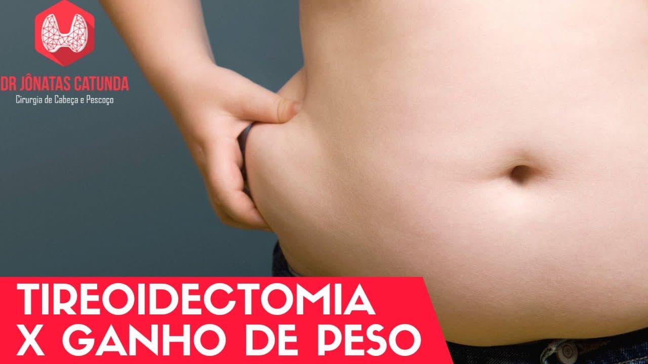 Cirurgia da tireóide engorda?