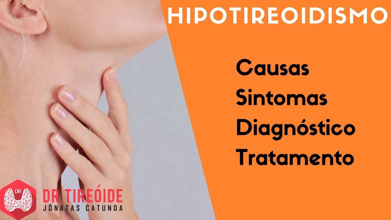 Hipotireoidismo - o que é? | Dr Jônatas Catunda