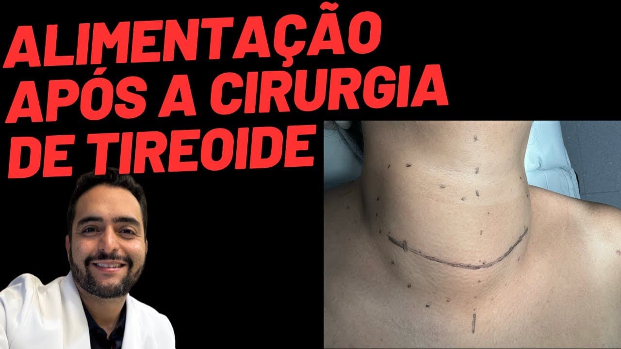 Alimentação após a cirurgia da tireoide: o que pode e o que evitar?