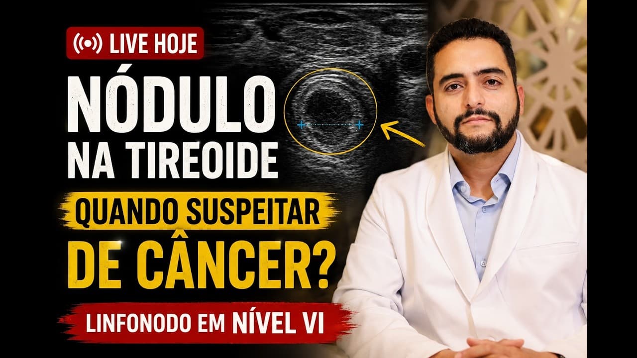 Nódulo na tireoide: 5 sinais que aumentam a suspeita de câncer