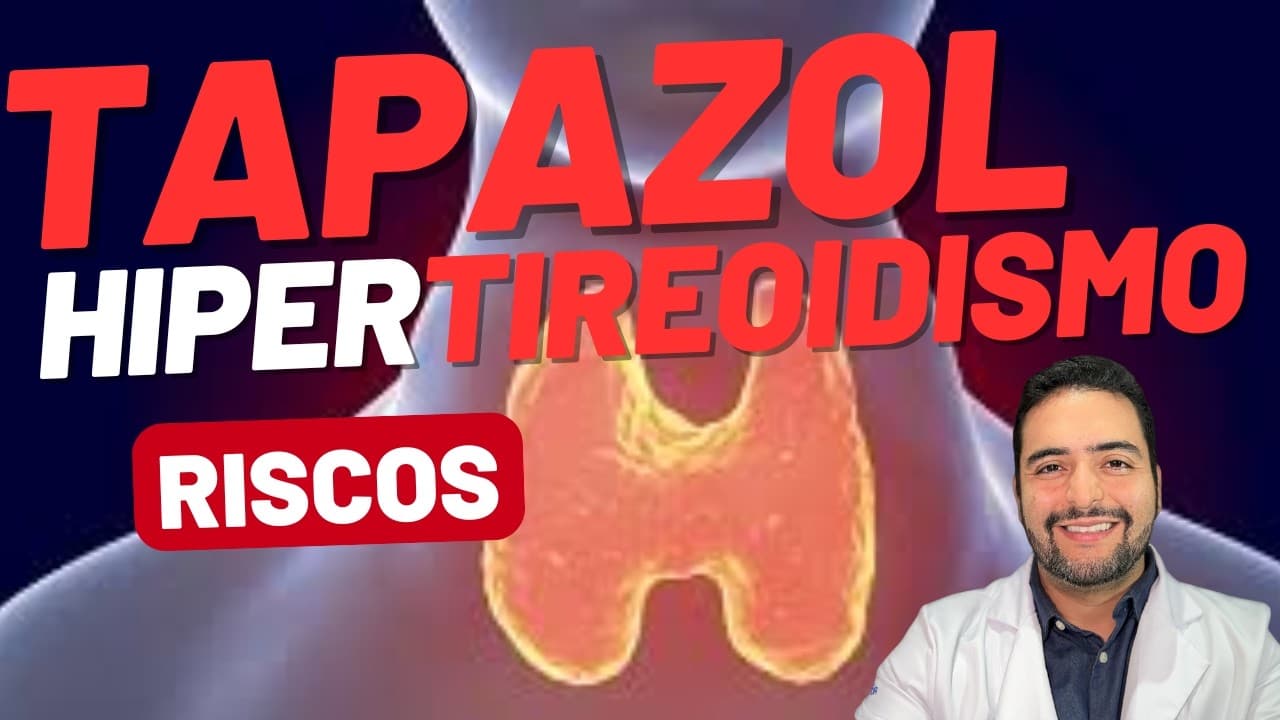 Tapazol (metimazol) é seguro? Efeitos colaterais