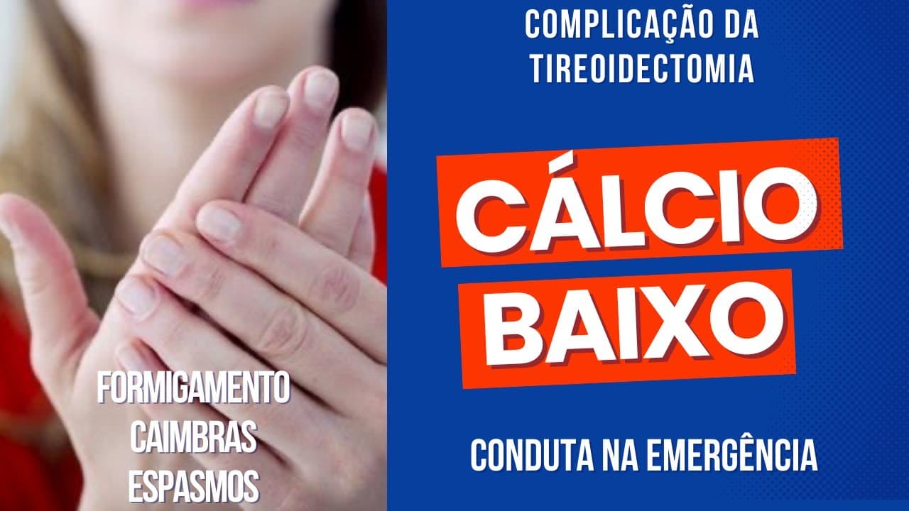 Complicações da tireoidectomia na EMERGÊNCIA - Hipoparatireoidismo / cálcio baixo